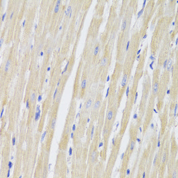Anti-Mitochondrial Fission 1 Protein Rabbit Polyclonal Antibody