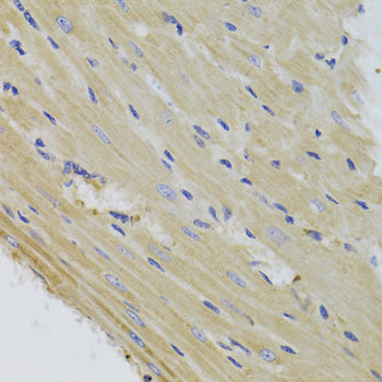 Anti-Mitochondrial Fission 1 Protein Rabbit Polyclonal Antibody
