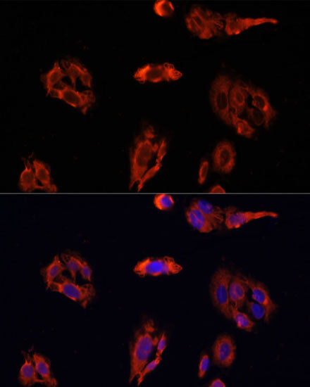 Anti-FAP Rabbit Polyclonal Antibody