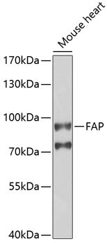 Anti-FAP Rabbit Polyclonal Antibody