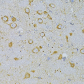 Anti-Thyrotropin Receptor Rabbit Polyclonal Antibody