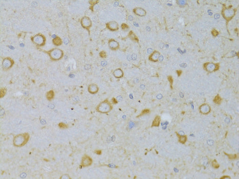 Anti-Thyrotropin Receptor Rabbit Polyclonal Antibody