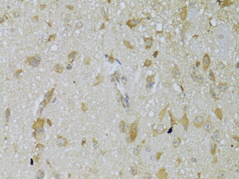 Anti-Thyrotropin Receptor Rabbit Polyclonal Antibody