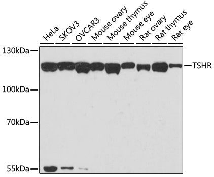 Anti-Thyrotropin Receptor Rabbit Polyclonal Antibody