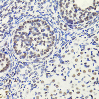 Anti-Acetyl-Histone H3 (Lys18) Rabbit Polyclonal Antibody