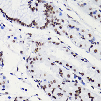 Anti-Acetyl-Histone H3 (Lys18) Rabbit Polyclonal Antibody