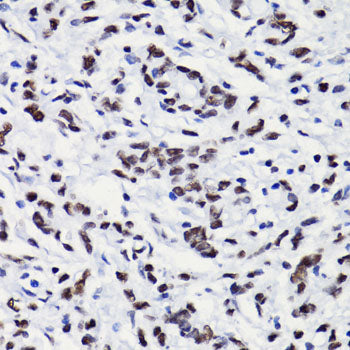 Anti-Acetyl-Histone H3 (Lys18) Rabbit Polyclonal Antibody