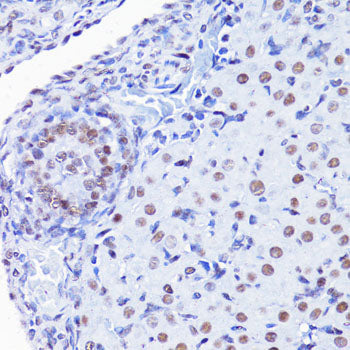 Anti-Acetyl-Histone H4 (Lys8) Rabbit Polyclonal Antibody