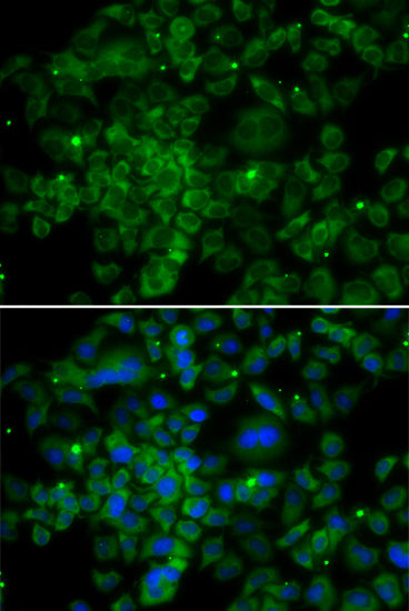 Anti-MCP1 Rabbit Polyclonal Antibody