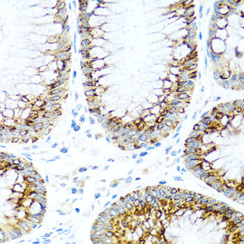 Anti-MCP1 Rabbit Polyclonal Antibody