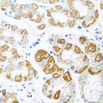 Anti-MCP1 Rabbit Polyclonal Antibody