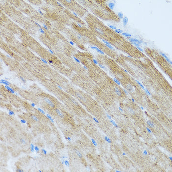 Anti-MCP1 Rabbit Polyclonal Antibody