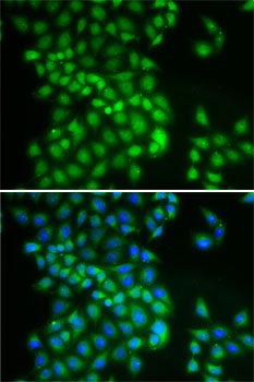 Anti-YTHDC1 Rabbit Polyclonal Antibody