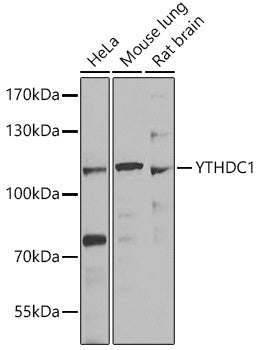 Anti-YTHDC1 Rabbit Polyclonal Antibody
