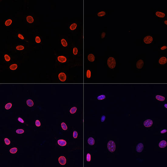 Anti-Acetyl-Histone H4 (Lys91) Rabbit Polyclonal Antibody