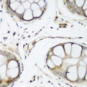 Anti-WWTR1 Rabbit Polyclonal Antibody