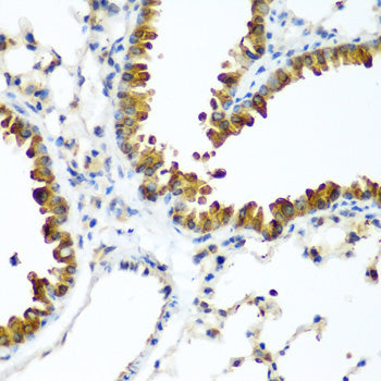 Anti-WWTR1 Rabbit Polyclonal Antibody