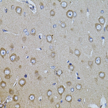 Anti-Integrin beta 8 Rabbit Polyclonal Antibody