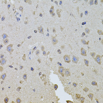 Anti-Integrin beta 8 Rabbit Polyclonal Antibody