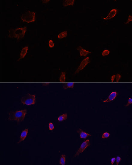 Anti-Aquaporin 3 Rabbit Polyclonal Antibody