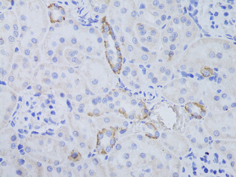 Anti-Aquaporin 3 Rabbit Polyclonal Antibody