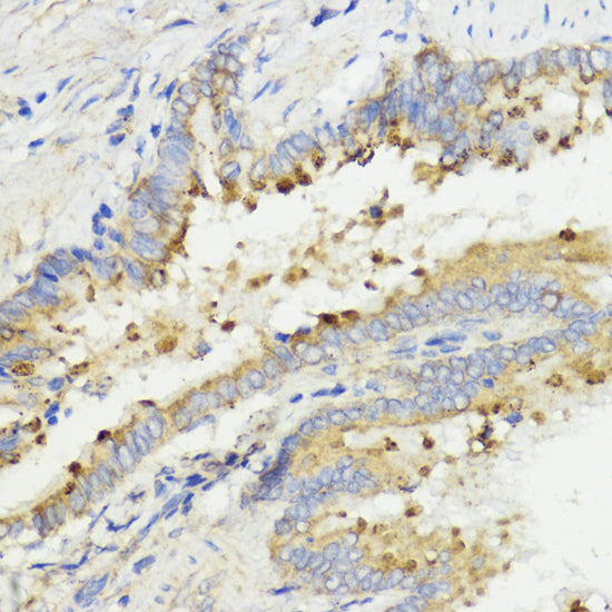 Anti-IGF1 Rabbit Polyclonal Antibody