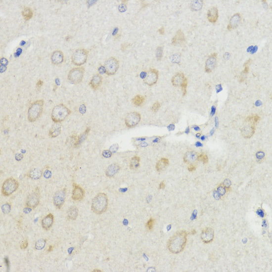 Anti-IGF1 Rabbit Polyclonal Antibody