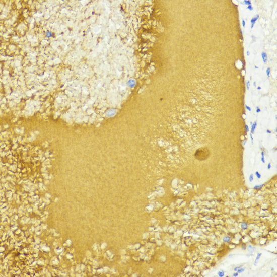 Anti-IGF1 Rabbit Polyclonal Antibody