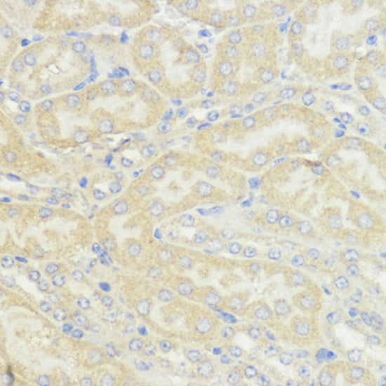 Anti-IGF1 Rabbit Polyclonal Antibody