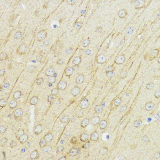 Anti-IGF1 Rabbit Polyclonal Antibody