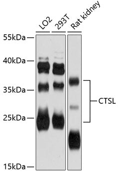 Anti-Cathepsin L Rabbit Polyclonal Antibody
