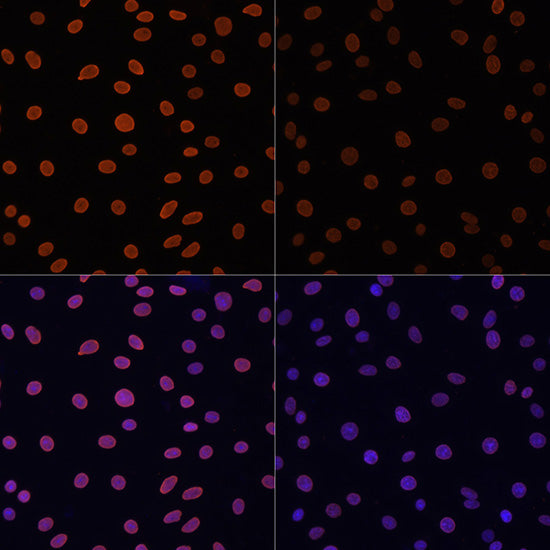 Anti-Acetyl-Histone H4 (Lys12) Rabbit Polyclonal Antibody