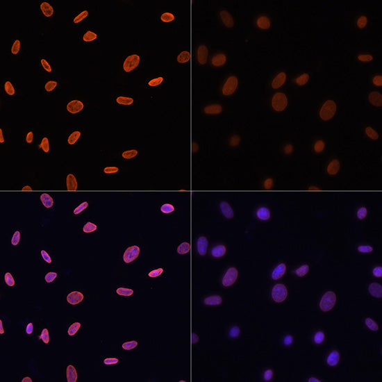 Anti-Acetyl-Histone H4 (Lys12) Rabbit Polyclonal Antibody