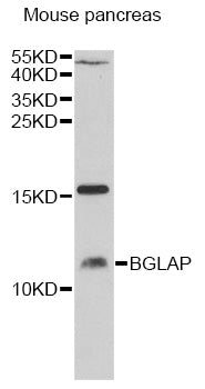 Anti-Osteocalcin Rabbit Polyclonal Antibody
