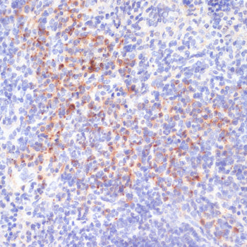Anti-Phospho-IRE1 (Ser724) Rabbit Polyclonal Antibody