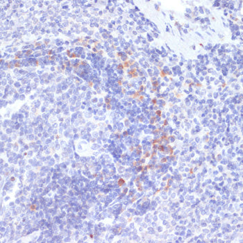 Anti-Phospho-IRE1 (Ser724) Rabbit Polyclonal Antibody