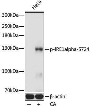 Anti-Phospho-IRE1 (Ser724) Rabbit Polyclonal Antibody