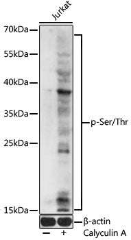 Anti-Phospho-Serine/Threonine Rabbit Polyclonal Antibody