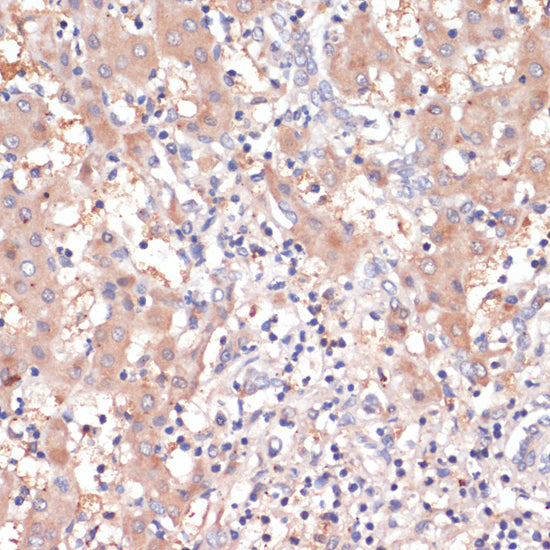 Anti-Cyclooxygenase 2 Rabbit Polyclonal Antibody