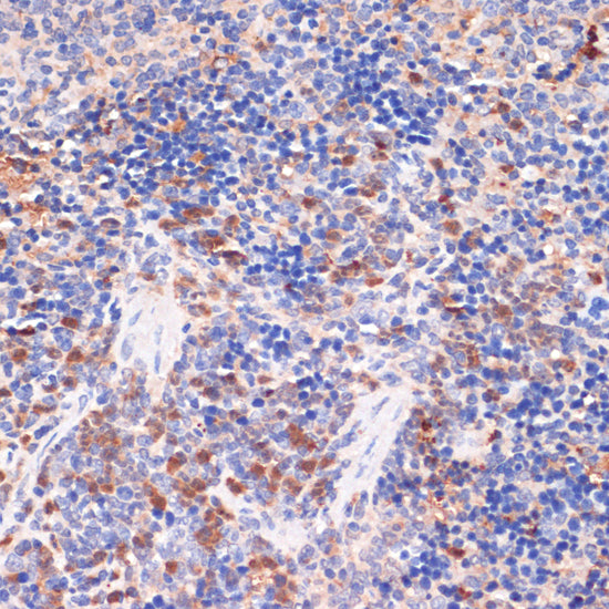 Anti-Cyclooxygenase 2 Rabbit Polyclonal Antibody