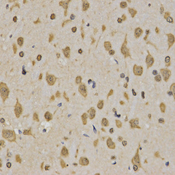 Anti-TriMethyl-Histone H3 (Lys4) Rabbit Polyclonal Antibody