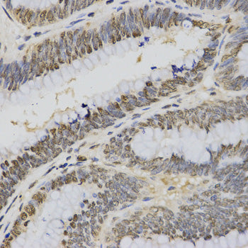 Anti-TriMethyl-Histone H3 (Lys4) Rabbit Polyclonal Antibody