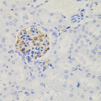 Anti-Nephrin Rabbit Polyclonal Antibody