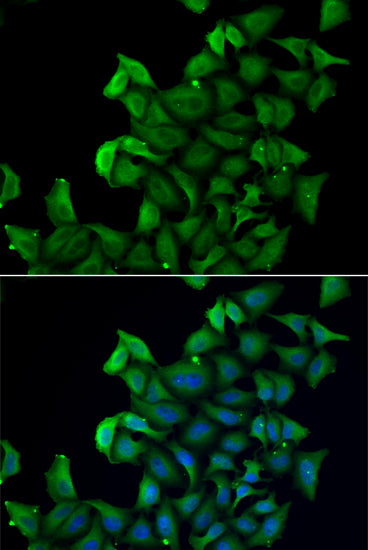 Anti-FABP5 Rabbit Polyclonal Antibody