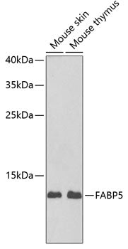 Anti-FABP5 Rabbit Polyclonal Antibody