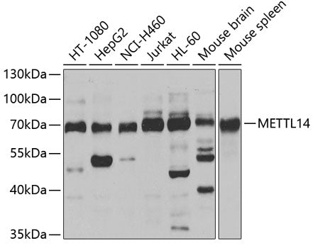 Anti-METTL14 Rabbit Polyclonal Antibody