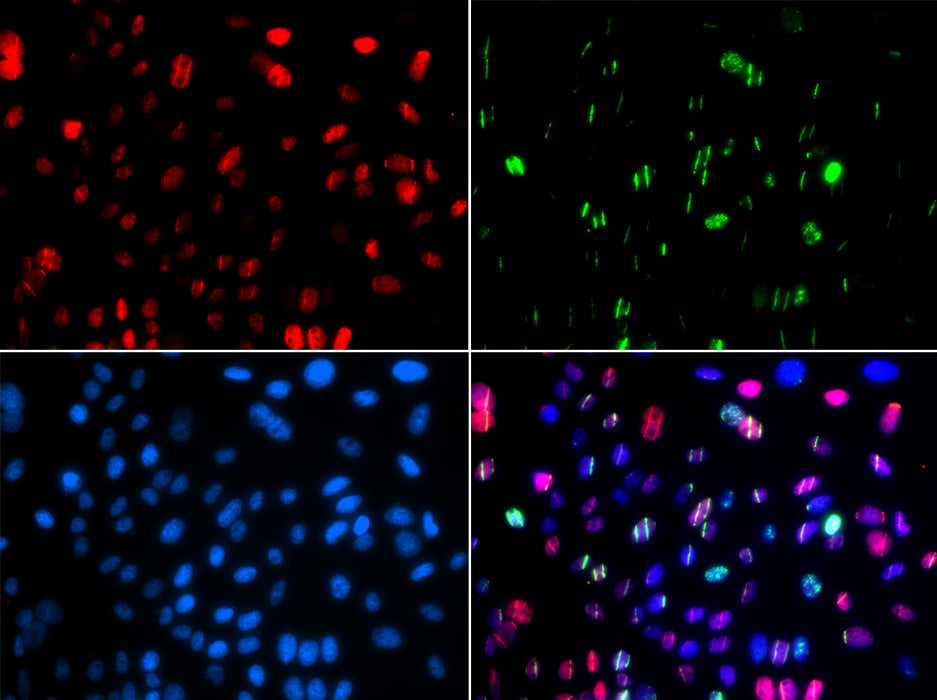 Anti-Phospho-p53 (Ser15) Rabbit Polyclonal Antibody