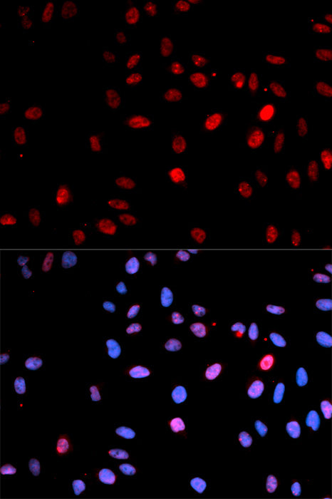 Anti-Phospho-p53 (Ser15) Rabbit Polyclonal Antibody