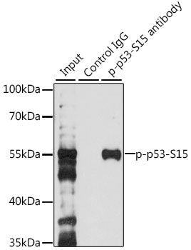 Anti-Phospho-p53 (Ser15) Rabbit Polyclonal Antibody