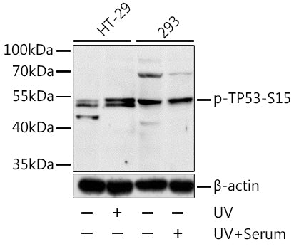 Anti-Phospho-p53 (Ser15) Rabbit Polyclonal Antibody